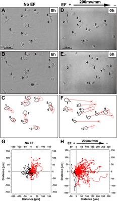 Migration of Human Renal Tubular Epithelial Cells in Response to Physiological Electric Signals